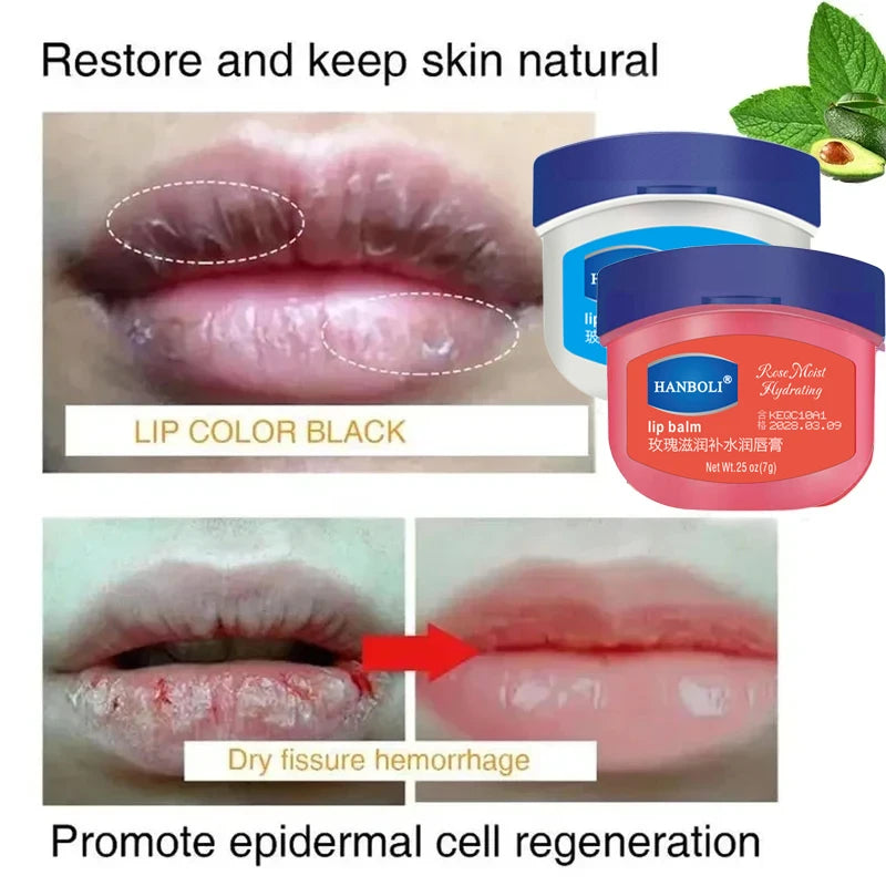 Remove Dark Lip Balm