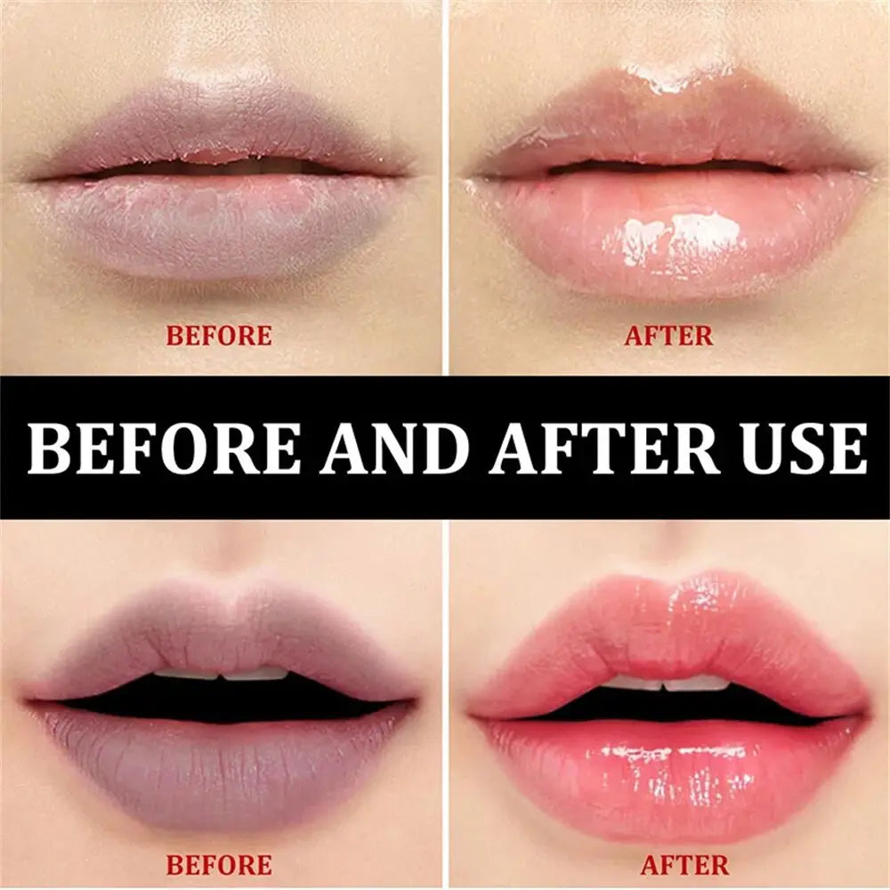 Remove Dark Lip Balm