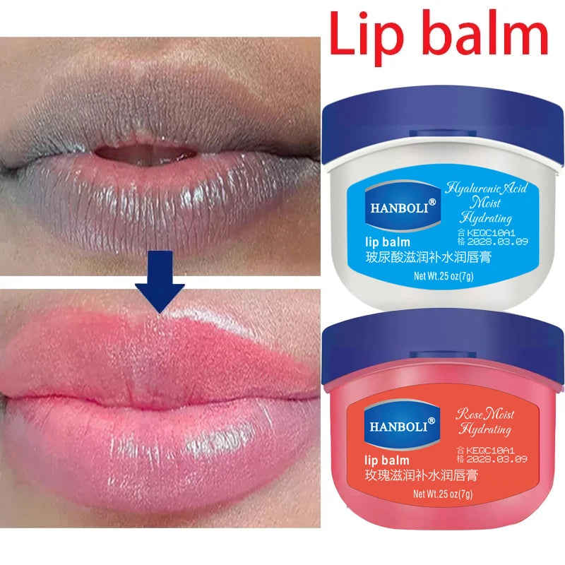 Remove Dark Lip Balm