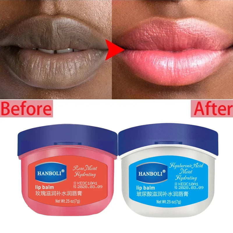 Remove Dark Lip Balm