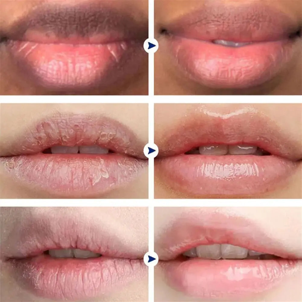 Remove Dark Lip Balm