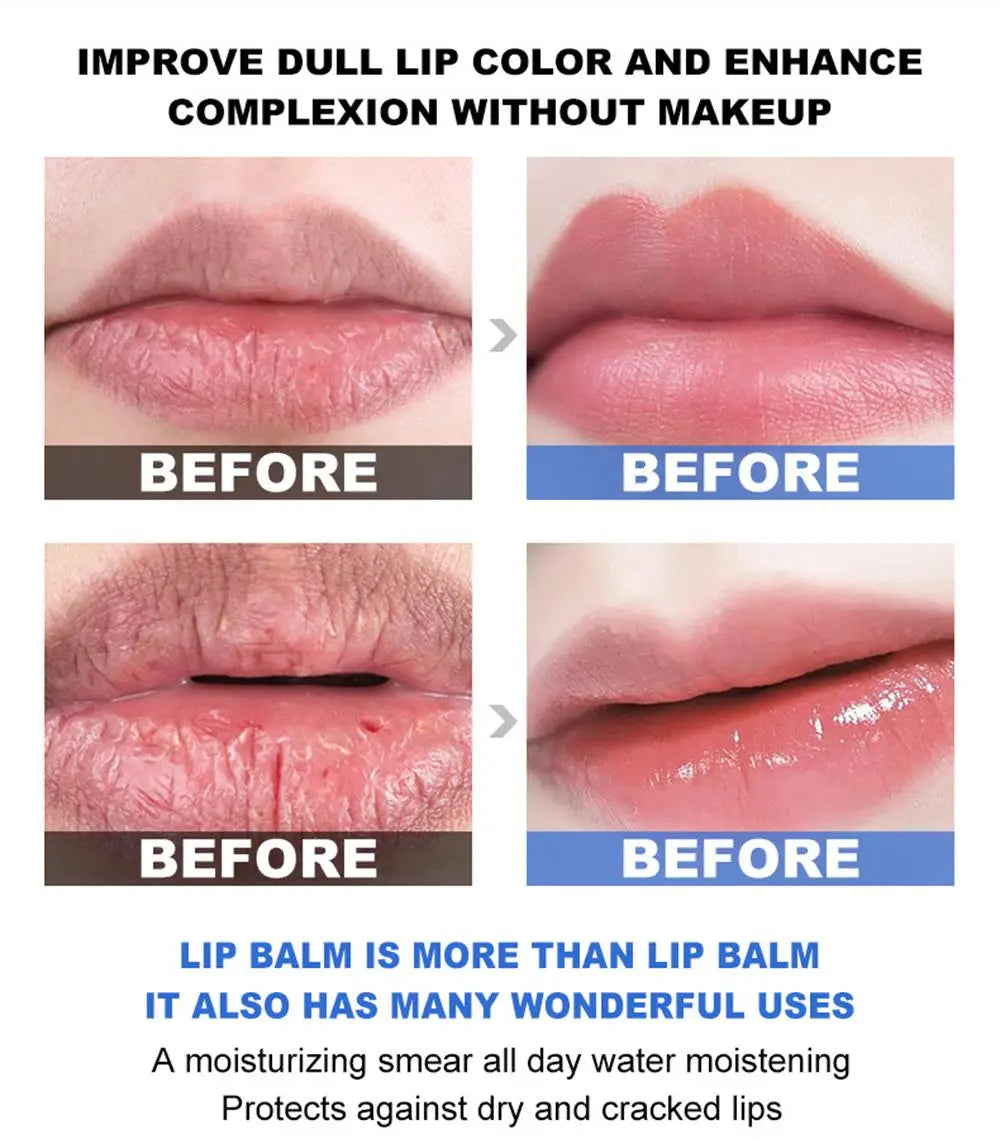 Remove Dark Lip Balm